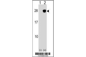 Western blot analysis of ULBP2 using rabbit polyclonal ULBP2 Antibody using 293 cell lysates (2 ug/lane) either nontransfected (Lane 1) or transiently transfected (Lane 2) with the ULBP2 gene.