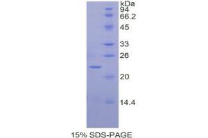 SDS-PAGE analysis of Horse Interleukin 1 alpha Protein. (IL1A Protéine)