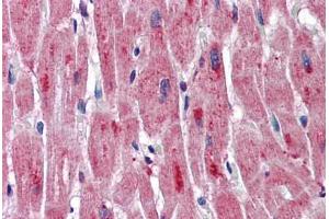 Human Heart: Formalin-Fixed, Paraffin-Embedded (FFPE)