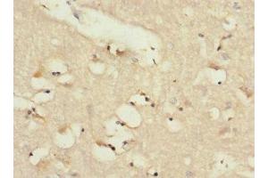 Immunohistochemistry of paraffin-embedded human brain tissue using ABIN7143394 at dilution of 1:100