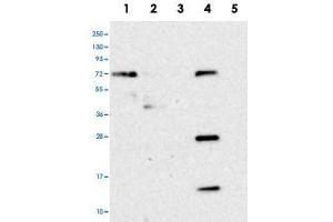 Western blot analysis of Lane 1: RT-4, Lane 2: U-251 MG, Lane 3: Human Plasma, Lane 4: Liver, Lane 5: Tonsil with HS2ST1 polyclonal antibody . (HS2ST1 anticorps)