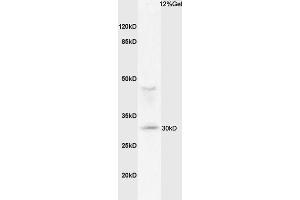 Mouse lung lysates probed with Anti MHC Class II Polyclonal Antibody, Unconjugated (ABIN1713842) at 1:200 overnight at 4 °C.