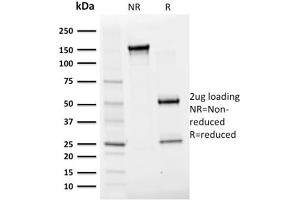 SDS-PAGE Analysis Purified Albumin Monospecific Mouse Monoclonal Antibody (ALB/2356).