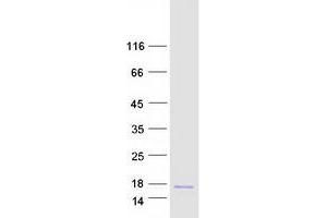 Validation with Western Blot