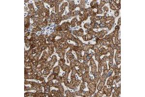 Immunohistochemical staining (Formalin-fixed paraffin-embedded sections) of human liver with ACAT1 polyclonal antibody  shows strong cytoplasmic positivity in hepatocytes. (ACAT1 anticorps)