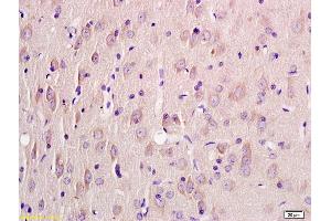 Formalin-fixed and paraffin embedded rat brain labeled with Rabbit Anti KRIT1 Polyclonal Antibody, Unconjugated (ABIN1387606) at 1:200 followed by conjugation to the secondary antibody and DAB staining (KRIT1 anticorps  (AA 631-736))