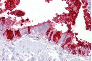 Immunohistochemistry with Lung, respiratory epithelium tissue at an antibody concentration of 5µg/ml using anti-SCGB1A1 antibody (ARP41524_P050)