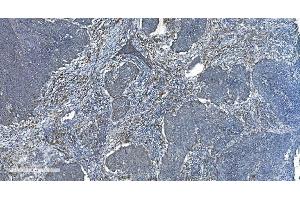 IHC analysis of TIMM8A/DDP using anti-TIMM8A/DDP antibody (ABIN7600039). (TIMM8A/DDP anticorps  (AA 14-97))