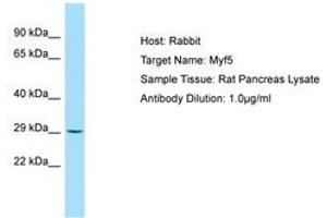 Image no. 1 for anti-Myogenic Factor 5 (MYF5) (AA 51-100) antibody (ABIN6749815) (MYF5 anticorps  (AA 51-100))