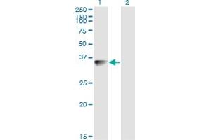 Western Blot analysis of BLVRA expression in transfected 293T cell line by BLVRA monoclonal antibody (M03), clone S2. (Biliverdin Reductase anticorps  (AA 1-296))