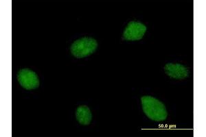 Immunofluorescence of purified MaxPab antibody to KIAA1604 on HeLa cell. (CWC22 anticorps  (AA 1-908))