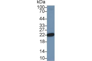 Western Blot; Sample: Human Jurkat cell lysate; Primary Ab: 2µg/ml Rabbit Anti-Human PARK7 Antibody Second Ab: 0.
