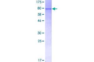 Image no. 1 for rho Guanine Nucleotide Exchange Factor (GEF) 5 (ARHGEF5) (AA 1-519) protein (GST tag) (ABIN1345560)