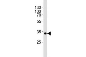 Western blot analysis of human recombinant protein using vWF antibody at 1:1000.