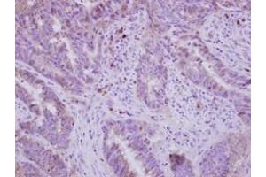 Image no. 1 for anti-Fatty Acid Desaturase 1 (FADS1) (AA 247-444) antibody (ABIN1498179)