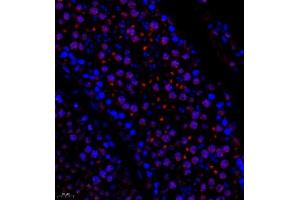 Immunofluorescence of paraffin embedded rat testis using Suv39h2 (ABIN7075771) at dilution of 1:2000 (400x lens)