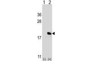 Western blot analysis of IL17A (arrow) using Interleukin-17A (IL17A) Antibody ; 293 cell lysates (2 ug/lane) either nontransfected (Lane 1) or transiently transfected (Lane 2) with the IL17A gene.