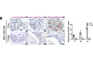 Infiltration of Cells and osteogenic differentiation MSCs around BCP dependent on T cells. (SETD7 anticorps  (AA 1-366))