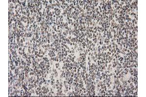 Image no. 11 for anti-Protein Kinase C, epsilon (PRKCE) antibody (ABIN1500229)