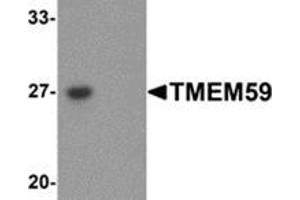 Western blot analysis of TMEM59 in human kidney tissue lysate with TMEM59 antibody at 1 μg/mL in (left) the absence and (right) the presence of blocking peptide. (TMEM59 anticorps  (N-Term))
