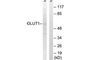 Western Blotting (WB) image for anti-Solute Carrier Family 2 (Facilitated Glucose Transporter), Member 1 (SLC2A1) (AA 441-490) antibody (ABIN2879123) (GLUT1 anticorps  (AA 441-490))