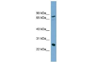 KLK5 antibody used at 1 ug/ml to detect target protein.