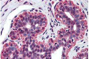 Human Breast (formalin-fixed, paraffin-embedded) stained with TP73 antibody ABIN298091 at 5 ug/ml followed by biotinylated anti-mouse IgG secondary antibody ABIN481714, alkaline phosphatase-streptavidin and chromogen. (Tumor Protein p73 anticorps  (N-Term))