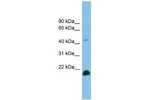 TGF beta 2 antibody used at 1 ug/ml to detect target protein. (TGFB2 anticorps  (Middle Region))