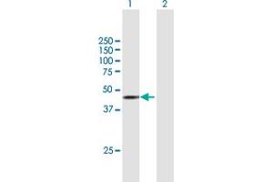 Western Blot analysis of STK17B expression in transfected 293T cell line by STK17B MaxPab polyclonal antibody. (DRAK2 anticorps  (AA 1-372))