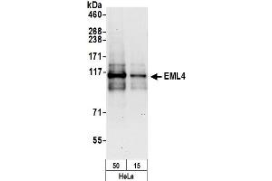 Western Blotting (WB) image for anti-Echinoderm Microtubule Associated Protein Like 4 (EML4) (AA 150-200) antibody (ABIN7454793) (EML4 anticorps  (AA 150-200))