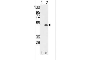 Western blot analysis of ETV4 (arrow) using rabbit polyclonal ETV4 Antibody (C-term) (R).