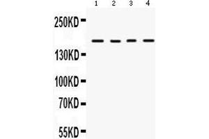 Anti-HKDC1 Picoband antibody, Western blotting All lanes: Anti HKDC1  at 0. (HKDC1 anticorps  (N-Term))