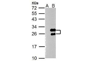 WB Image Twist1 antibody [N1C3] detects Twist1 protein by Western blot analysis. (TWIST1 anticorps  (Center))
