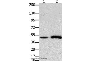 Western blot analysis of Mouse brain and  heart tissue, using FOXL2 Polyclonal Antibody at dilution of 1:750 (FOXL2 anticorps)