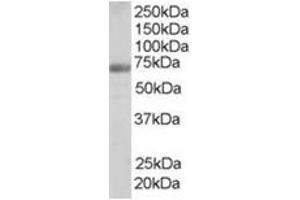 Image no. 1 for anti-Formin Binding Protein 1 (FNBP1) (Internal Region) antibody (ABIN374468) (FNBP1 anticorps  (Internal Region))