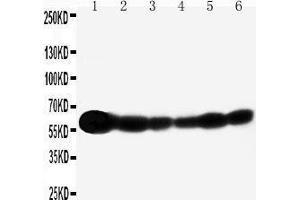 Anti-SHC antibody, Western blotting Lane 1: Rat Brain Tissue Lysate Lane 2: A549 Cell Lysate Lane 3: A431 Cell Lysate Lane 4: 293T Cell Lysate Lane 5: HELA Cell Lysate Lane 6: JURKAT Cell Lysate