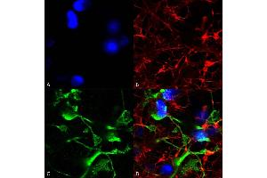 Immunocytochemistry/Immunofluorescence analysis using Mouse Anti-SUR2A Monoclonal Antibody, Clone S319A-14 (ABIN2482971). (ABCC9 anticorps  (AA 1505-1546) (Atto 594))