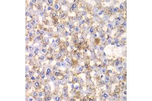 Immunohistochemistry of paraffin-embedded rat liver using H antibody (ABIN6129787, ABIN6141601, ABIN6141603 and ABIN6216048) at dilution of 1:100 (40x lens). (HAPLN1 anticorps  (AA 165-354))