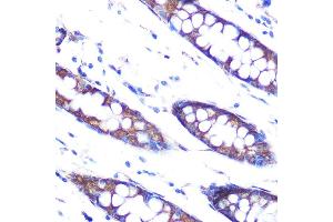 Immunohistochemistry of paraffin-embedded human colon using HSP47/SERPINH1 Rabbit mAb (ABIN7270238) at dilution of 1:100 (40x lens).