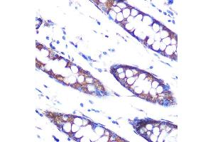 Immunohistochemistry of paraffin-embedded human colon using HSP47/SERPINH1 Rabbit mAb (ABIN7270238) at dilution of 1:100 (40x lens). (SERPINH1 anticorps)