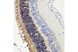 Immunohistochemistry of paraffin-embedded mouse retina using RCVRN antibody (ABIN6128676, ABIN6146832, ABIN6146833 and ABIN6222036) at dilution of 1:200 (40x lens).