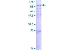 Image no. 1 for Propionyl CoA Carboxylase, alpha Polypeptide (PCCA) (AA 1-703) protein (GST tag) (ABIN1314137)