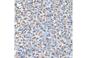 Immunohistochemistry of paraffin-embedded rat stomach using B Rabbit mAb (ABIN7265767) at dilution of 1:100 (40x lens). (ATP4b anticorps)
