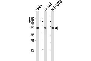 Western blot analysis of lysates from Hela, Jurkat, mouse NIH/3T3 cell line (from left to right), using ARA Antibody (ABIN1944858 and ABIN2838532). (PPARA anticorps  (AA 1-468))