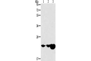 Gel: 10 % SDS-PAGE, Lysate: 40 μg, Lane 1-3: Mouse kidney tissue, Mouse liver tissue, human fetal liver tissue, Primary antibody: ABIN7191000(HRASLS2 Antibody) at dilution 1/362. (HRASLS2 anticorps)