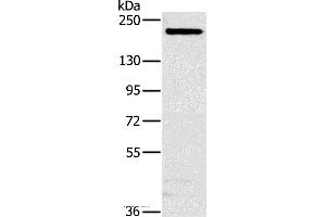 Western blot analysis of Hela cell, using NCOA3 Polyclonal Antibody at dilution of 1:200 (NCOA3 anticorps)