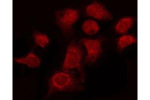 ABIN6274174 staining Hela by IF/ICC. (BRAF anticorps  (Internal Region))