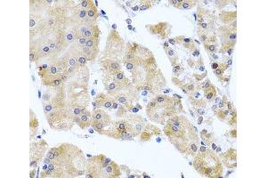 Immunohistochemistry of paraffin-embedded Human stomach using CETN3 Polyclonal Antibody at dilution of 1:100 (40x lens).