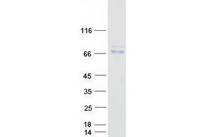 Validation with Western Blot