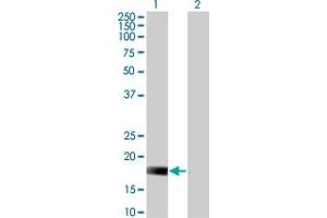Western Blot analysis of DUSP22 expression in transfected 293T cell line by DUSP22 monoclonal antibody (M01), clone 3D3. (DUSP22 anticorps  (AA 112-184))